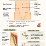 Illustration représentant les différents types de hernies abdominales